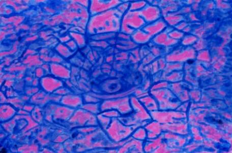 Vertiefung 2 (1997) - Monika Knaack - Monika Knaack - Array auf Array - Array - Vertiefung 2 (1997) - Monika Knaack - Monika Knaack - Array auf Array - Array -